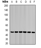 KRT18 / CK18 / Cytokeratin 18 Antibody - Western blot analysis of Cytokeratin 18 expression in HepG2 (A); HeLa (B); mouse liver (C); mouse skeletal muscle (D); C2C12 (E); rat heart (F) whole cell lysates.