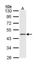 KRT18 / CK18 / Cytokeratin 18 Antibody - Sample (30 ug of whole cell lysate). A: Raji. 10% SDS PAGE. KRT18 antibody diluted at 1:10000. 
