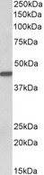 KRT19 / CK19 / Cytokeratin 19 Antibody - KRT19 antibody E12359 (0.1 ug/ml) staining of Human Breast cancer lysate (35 ug protein in RIPA buffer). Primary incubation was 1 hour. Detected by chemiluminescence.