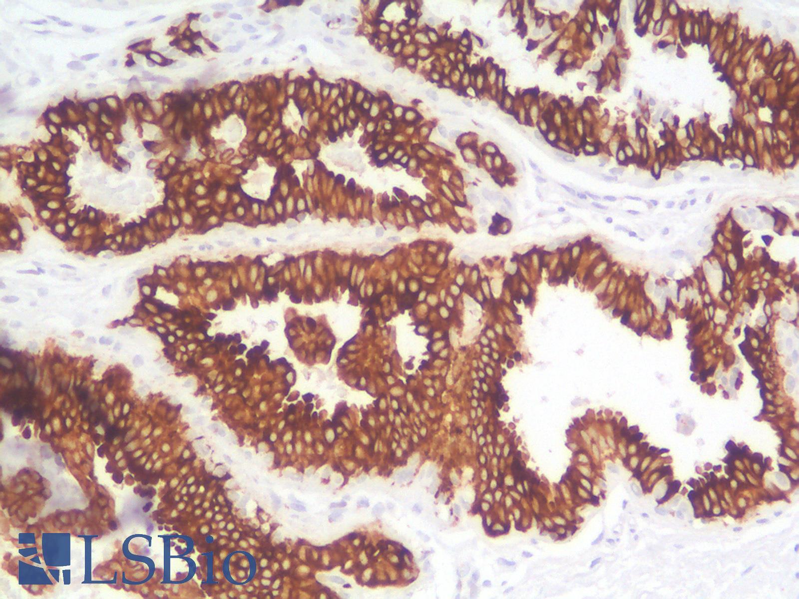 KRT19 / CK19 / Cytokeratin 19 Antibody - Human Breast: Formalin-Fixed, Paraffin-Embedded (FFPE)