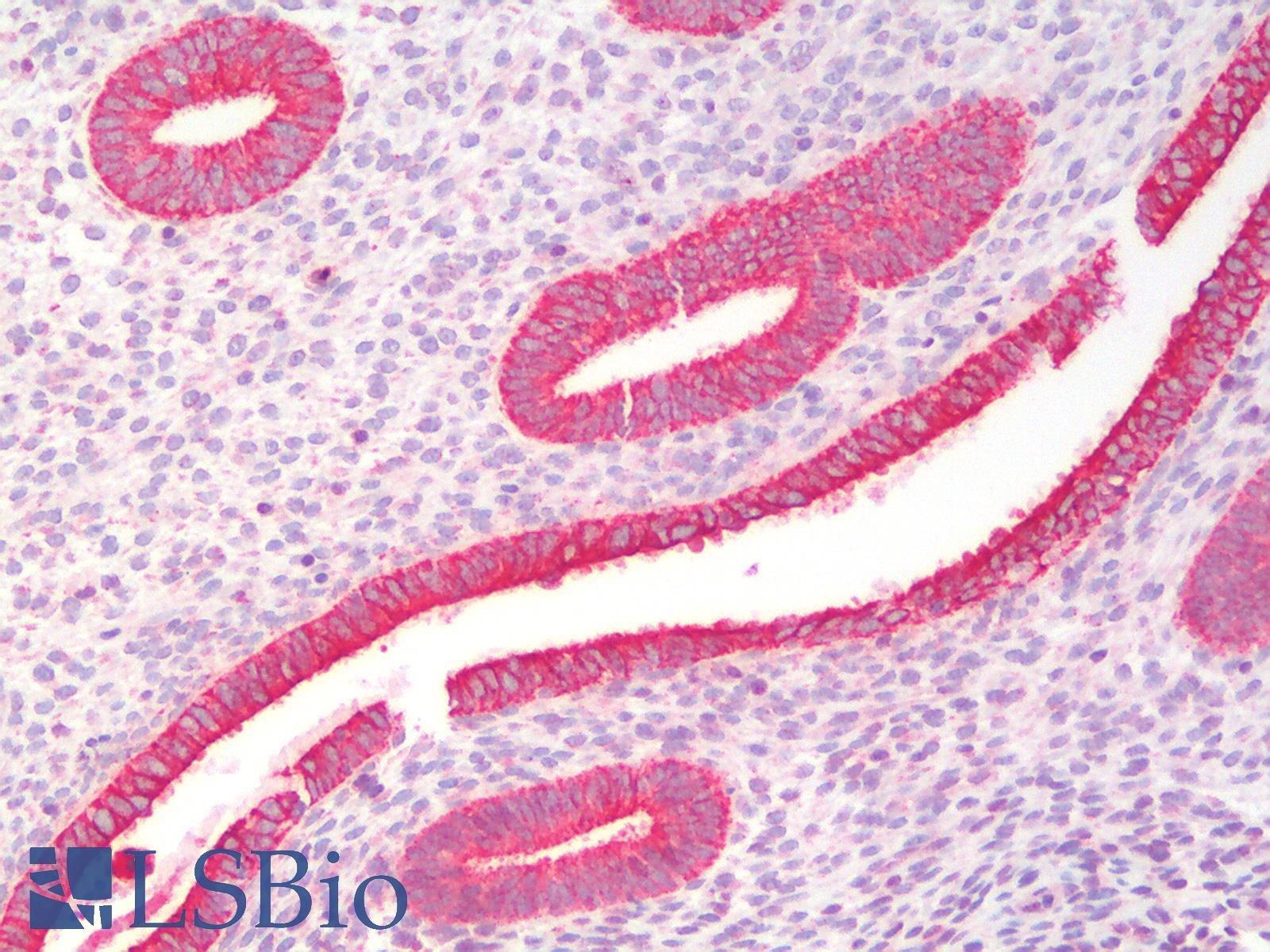 KRT19 / CK19 / Cytokeratin 19 Antibody - Human Uterus: Formalin-Fixed, Paraffin-Embedded (FFPE)