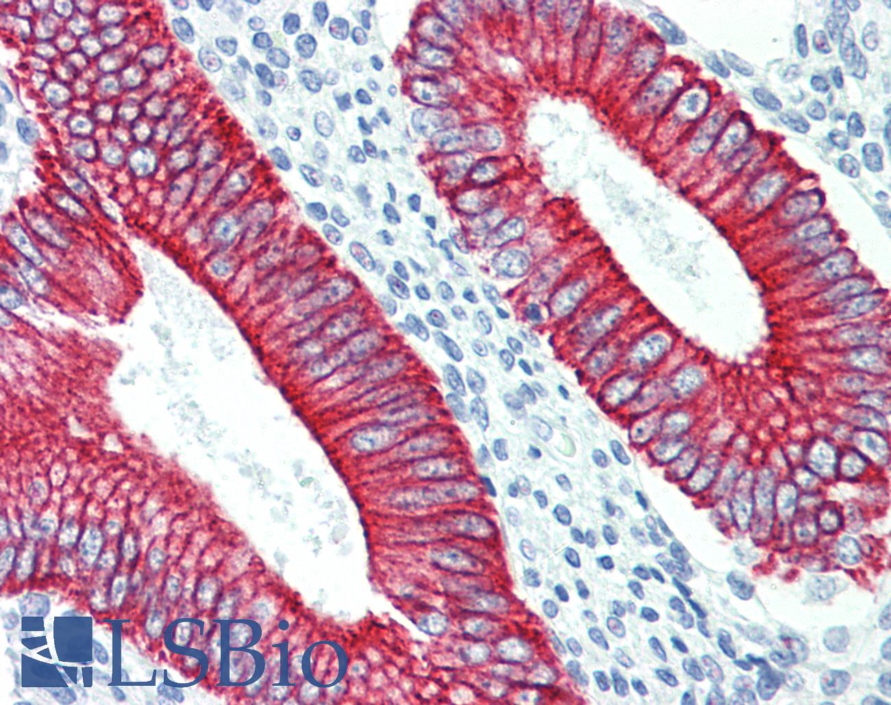 KRT19 / CK19 / Cytokeratin 19 Antibody - Anti-KRT19 / CK19 / Cytokeratin 19 antibody IHC staining of human uterus, endometrium. Immunohistochemistry of formalin-fixed, paraffin-embedded tissue after heat-induced antigen retrieval. Antibody concentration 5 ug/ml.  This image was taken for the unconjugated form of this product. Other forms have not been tested.