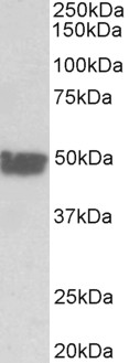 KRT20 / CK20 / Cytokeratin 20 Antibody - KRT20 antibody (0.03 ug/ml) staining of Human Colon lysate (35 ug protein in RIPA buffer). Primary incubation was 1 hour. Detected by chemiluminescence.