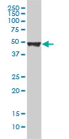 KRT20 / CK20 / Cytokeratin 20 Antibody - KRT20 monoclonal antibody, clone 2G3-1C8 Western blot of KRT20 expression in A-431.