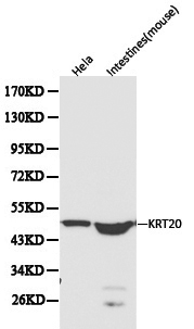 KRT20 / CK20 / Cytokeratin 20 Antibody - Western blot of Cytokeratin 20 pAb in extracts from Hela cells and mouse intestines tissue.