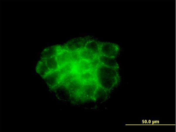 KRT4 / CK4 / Cytokeratin 4 Antibody - Immunofluorescence of monoclonal antibody to KRT4 on A-431 cell. [antibody concentration 10 ug/ml]