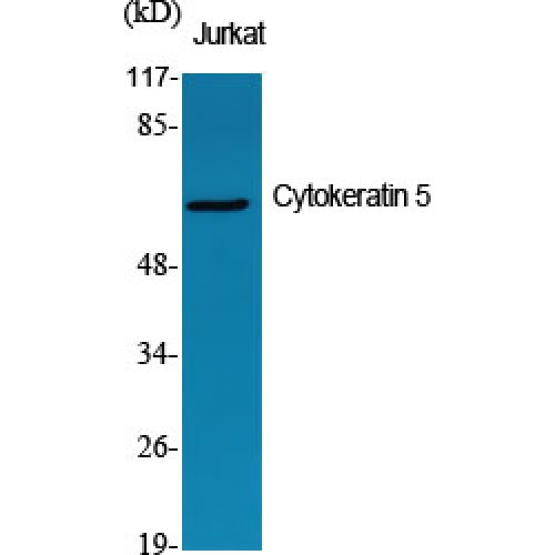 KRT5 / CK5 / Cytokeratin 5 Antibody - Western blot of Cytokeratin 5 antibody
