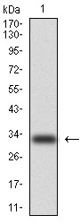 KRT5 / CK5 / Cytokeratin 5 Antibody - Western blot using CK5 monoclonal antibody against human CK5 (AA: 158-272) recombinant protein. (Expected MW is 33.3 kDa)