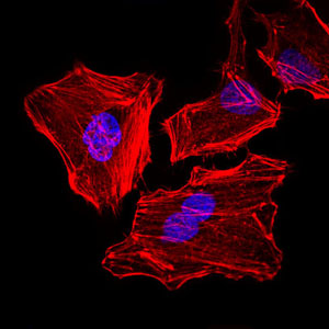KRT5 / CK5 / Cytokeratin 5 Antibody - Immunofluorescence of HeLa cells. Blue: DRAQ5 fluorescent DNA dye. Red: Actin filaments have been labeled with Alexa Fluor-555 phalloidin.