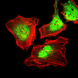 KRT5 / CK5 / Cytokeratin 5 Antibody - Immunofluorescence of HeLa cells using CK5 mouse monoclonal antibody (green). Red: Actin filaments have been labeled with Alexa Fluor-555 phalloidin.