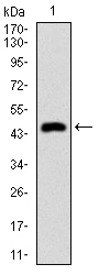 KRT5 / CK5 / Cytokeratin 5 Antibody - Western blot using CK5 monoclonal antibody against human CK5 recombinant protein. (Expected MW is 47.8 kDa)
