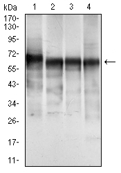 KRT5 / CK5 / Cytokeratin 5 Antibody - Western blot using CK5 mouse monoclonal antibody against A431 (1), MCF-7 (2), HeLa (3) and HepG2 (4) cell lysate.
