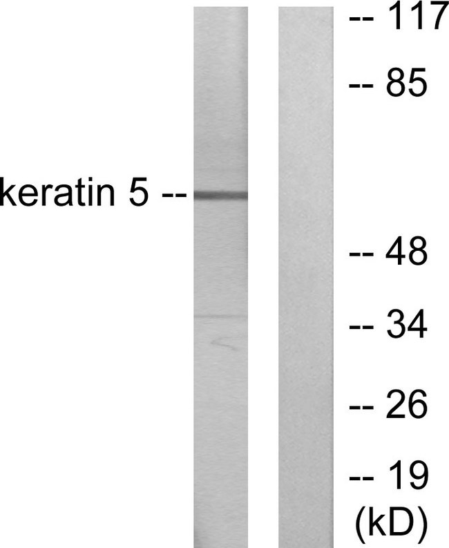KRT5 / CK5 / Cytokeratin 5 Antibody - Western blot analysis of lysates from HepG2 cells, using Keratin 5 Antibody. The lane on the right is blocked with the synthesized peptide.