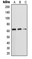 KRT5 / CK5 / Cytokeratin 5 Antibody - Western blot analysis of Cytokeratin 5 expression in DU145 (A); HeLa (B); MCF7 (C) whole cell lysates.