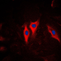 KRT5 / CK5 / Cytokeratin 5 Antibody - Immunofluorescent analysis of Cytokeratin 5 staining in HeLa cells. Formalin-fixed cells were permeabilized with 0.1% Triton X-100 in TBS for 5-10 minutes and blocked with 3% BSA-PBS for 30 minutes at room temperature. Cells were probed with the primary antibody in 3% BSA-PBS and incubated overnight at 4 C in a humidified chamber. Cells were washed with PBST and incubated with a DyLight 594-conjugated secondary antibody (red) in PBS at room temperature in the dark. DAPI was used to stain the cell nuclei (blue).