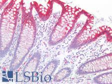 KRT5 / CK5 / Cytokeratin 5 Antibody - Human Colon: Formalin-Fixed, Paraffin-Embedded (FFPE)