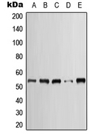 KRT7 / CK7 / Cytokeratin 7 Antibody - Western blot analysis of Cytokeratin 7 expression in HeLa (A); SP2/0 (B); H9C2 (C); A431 (D); NIH3T3 (E) whole cell lysates.