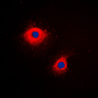 KRT7 / CK7 / Cytokeratin 7 Antibody - Immunofluorescent analysis of Cytokeratin 7 staining in HeLa cells. Formalin-fixed cells were permeabilized with 0.1% Triton X-100 in TBS for 5-10 minutes and blocked with 3% BSA-PBS for 30 minutes at room temperature. Cells were probed with the primary antibody in 3% BSA-PBS and incubated overnight at 4 C in a humidified chamber. Cells were washed with PBST and incubated with a DyLight 594-conjugated secondary antibody (red) in PBS at room temperature in the dark. DAPI was used to stain the cell nuclei (blue).