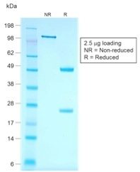 KRT7 / CK7 / Cytokeratin 7 Antibody - SDS-PAGE Analysis Purified CK7 Recombinant Mouse Monoclonal Antibody (rOV-TL12/30). Confirmation of Purity and Integrity of Antibody.