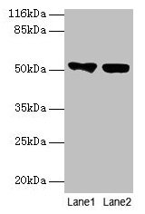 KRT8 / CK8 / Cytokeratin 8 Antibody - Western blot All lanes: KRT8 antibody at 2µg/ml Lane 1: A549 whole cell lysate Lane 2: MCF-7 whole cell lysate Secondary Goat polyclonal to rabbit IgG at 1/10000 dilution Predicted band size: 54, 57 kDa Observed band size: 54 kDa