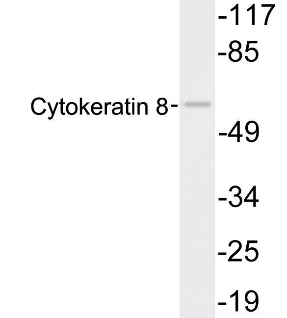 KRT8 / CK8 / Cytokeratin 8 Antibody - Western blot analysis of lysates from 293 cells, using Cytokeratin 8 antibody.