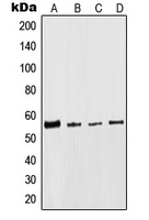KRT8 / CK8 / Cytokeratin 8 Antibody - Western blot analysis of Cytokeratin 8 expression in HeLa (A); NIH3T3 (B); H9C2 (C); MCF7 (D) whole cell lysates.