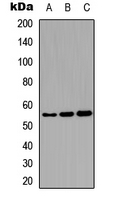 KRT8 / CK8 / Cytokeratin 8 Antibody - Western blot analysis of Cytokeratin 8 (pS432) expression in H522 (A); H1792 (B); mouse pancreatic cancer (C) whole cell lysates.
