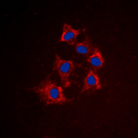 KRT8 / CK8 / Cytokeratin 8 Antibody - Immunofluorescent analysis of Cytokeratin 8 (pS432) staining in HeLa cells. Formalin-fixed cells were permeabilized with 0.1% Triton X-100 in TBS for 5-10 minutes and blocked with 3% BSA-PBS for 30 minutes at room temperature. Cells were probed with the primary antibody in 3% BSA-PBS and incubated overnight at 4 deg C in a humidified chamber. Cells were washed with PBST and incubated with a DyLight 594-conjugated secondary antibody (red) in PBS at room temperature in the dark. DAPI was used to stain the cell nuclei (blue).