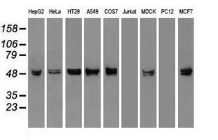 KRT8 / CK8 / Cytokeratin 8 Antibody - Western blot of extracts (35 ug) from 9 different cell lines by using anti-KRT8 monoclonal antibody.