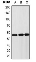KRT8 / CK8 / Cytokeratin 8 Antibody - Western blot analysis of Cytokeratin 8 expression in DLD (A); mouse muscle (B); rat muscle (C) whole cell lysates.