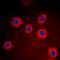 KRT8 / CK8 / Cytokeratin 8 Antibody - Immunofluorescent analysis of Cytokeratin 8 staining in DLD cells. Formalin-fixed cells were permeabilized with 0.1% Triton X-100 in TBS for 5-10 minutes and blocked with 3% BSA-PBS for 30 minutes at room temperature. Cells were probed with the primary antibody in 3% BSA-PBS and incubated overnight at 4 C in a humidified chamber. Cells were washed with PBST and incubated with a DyLight 594-conjugated secondary antibody (red) in PBS at room temperature in the dark. DAPI was used to stain the cell nuclei (blue).