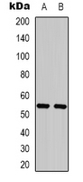 KRT8 / CK8 / Cytokeratin 8 Antibody - Western blot analysis of Cytokeratin 8 expression in HeLa (A); mouse brain (B) whole cell lysates.