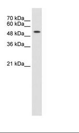 KRT8 / CK8 / Cytokeratin 8 Antibody - Jurkat Cell Lysate.  This image was taken for the unconjugated form of this product. Other forms have not been tested.
