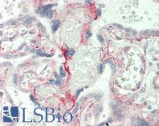 LAMC1 / Laminin Gamma 1 Antibody - Human Placenta: Formalin-Fixed, Paraffin-Embedded (FFPE)