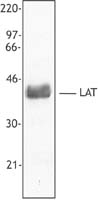LAT Antibody - Whole cell extract from human peripheral blood mononuclear cells was resolved by electrophoresis, transferred to nitrocellulose and probed with monoclonal anti-LAT antibody. Proteins were visualized using a goat anti-mouse secondary antibody conjugated to HRP and a chemiluminescence system.