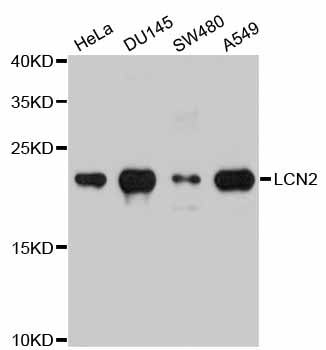LCN2 / Lipocalin 2 / NGAL Antibody - Western blot analysis of extracts of various cell lines.
