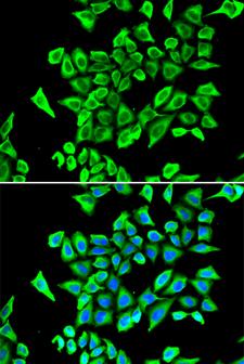 LCN2 / Lipocalin 2 / NGAL Antibody - Immunofluorescence analysis of A549 cells.