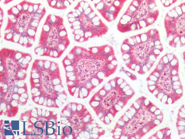 LDLR / LDL Receptor Antibody - Human Small Intestine: Formalin-Fixed, Paraffin-Embedded (FFPE)
