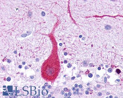 Leukotriene B4 Receptor / BLT1 Antibody - Brain, Cerebellum, Purkinje neuron