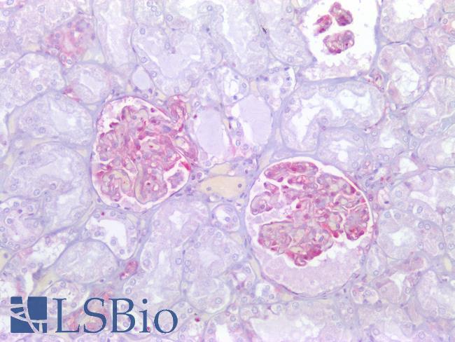 LGALS1 / Galectin 1 Antibody - Human Kidney, Glomerulus: Formalin-Fixed, Paraffin-Embedded (FFPE)