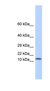 LGALS1 / Galectin 1 Antibody - LGALS1 / Galectin 1 antibody Western blot of Fetal Muscle lysate. This image was taken for the unconjugated form of this product. Other forms have not been tested.