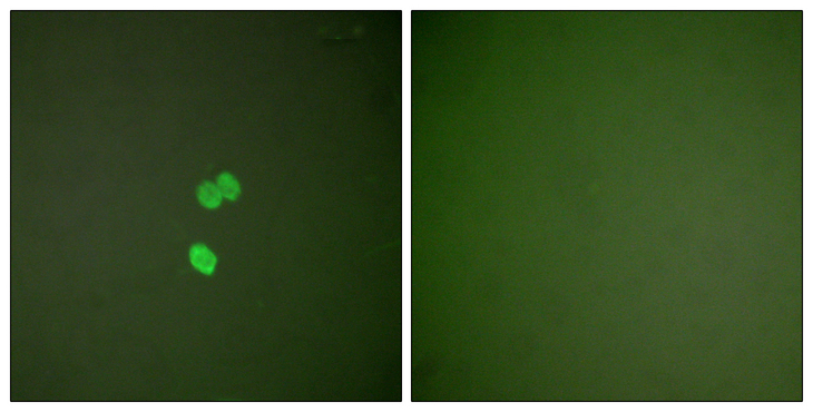 LGALS3 / Galectin 3 Antibody - Immunofluorescence analysis of NIH/3T3 cells, using Galectin 3 Antibody. The picture on the right is blocked with the synthesized peptide.