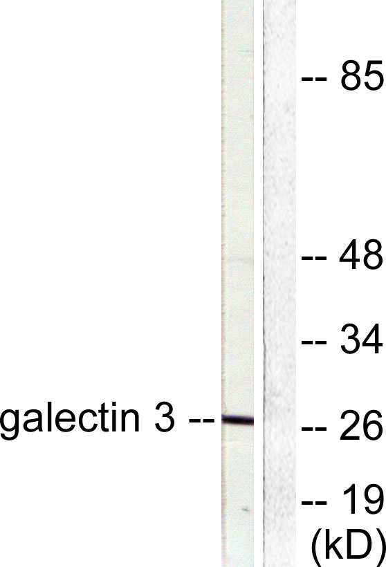 LGALS3 / Galectin 3 Antibody - Western blot analysis of lysates from HeLa cells, using Galectin 3 Antibody. The lane on the right is blocked with the synthesized peptide.