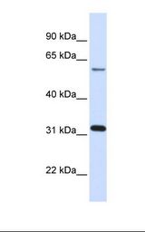LGALS3 / Galectin 3 Antibody - Human fetal lung lysate. Antibody concentration: 1.0 ug/ml. Gel concentration: 12%.  This image was taken for the unconjugated form of this product. Other forms have not been tested.