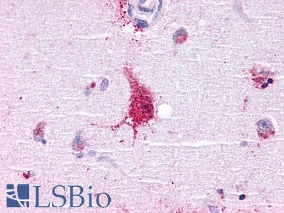 LGR6 Antibody - Brain, Amygdala