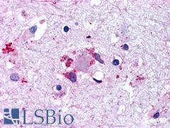 LGR6 Antibody - Brain, Alzheimer's disease, neuritic plaque