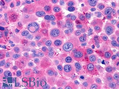 LGR6 Antibody - Skin, melanoma
