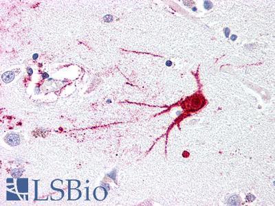LGR6 Antibody - Anti-LGR6 antibody IHC of human brain, neuron. Immunohistochemistry of formalin-fixed, paraffin-embedded tissue after heat-induced antigen retrieval.