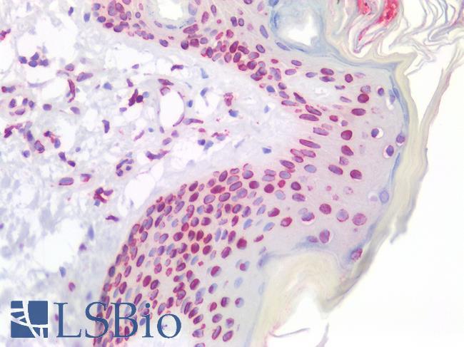 LMNB1 / Lamin B1 Antibody - Human Skin: Formalin-Fixed, Paraffin-Embedded (FFPE)