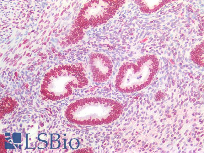 LMNB1 / Lamin B1 Antibody - Human Uterus: Formalin-Fixed, Paraffin-Embedded (FFPE)